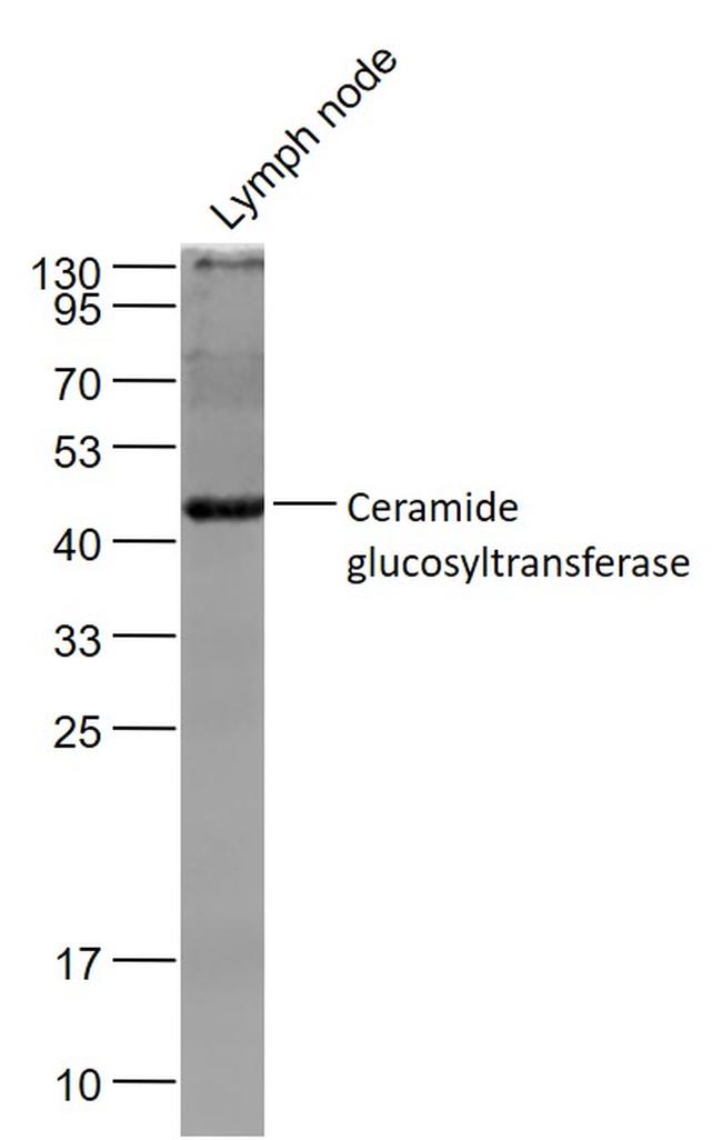 UGCG Antibody in Western Blot (WB)