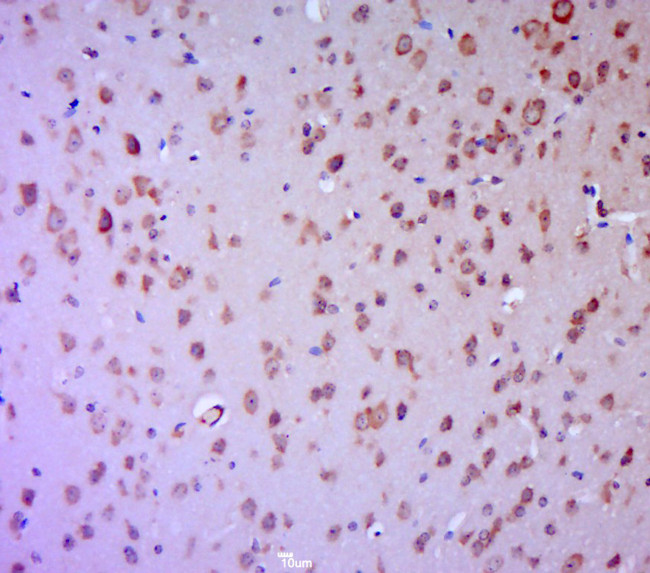 Phospho-PKC Epsilon (Ser729) Antibody in Immunohistochemistry (Paraffin) (IHC (P))