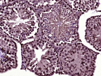 Cdc14A Antibody in Immunohistochemistry (Paraffin) (IHC (P))
