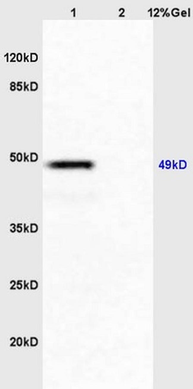 HNF3 alpha Antibody in Western Blot (WB)