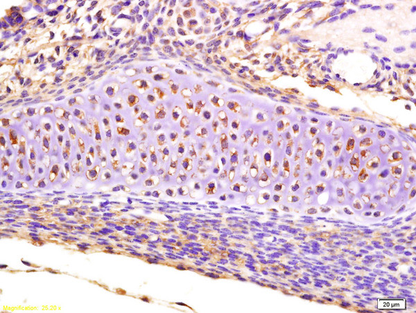 CRLF1 Antibody in Immunohistochemistry (Paraffin) (IHC (P))