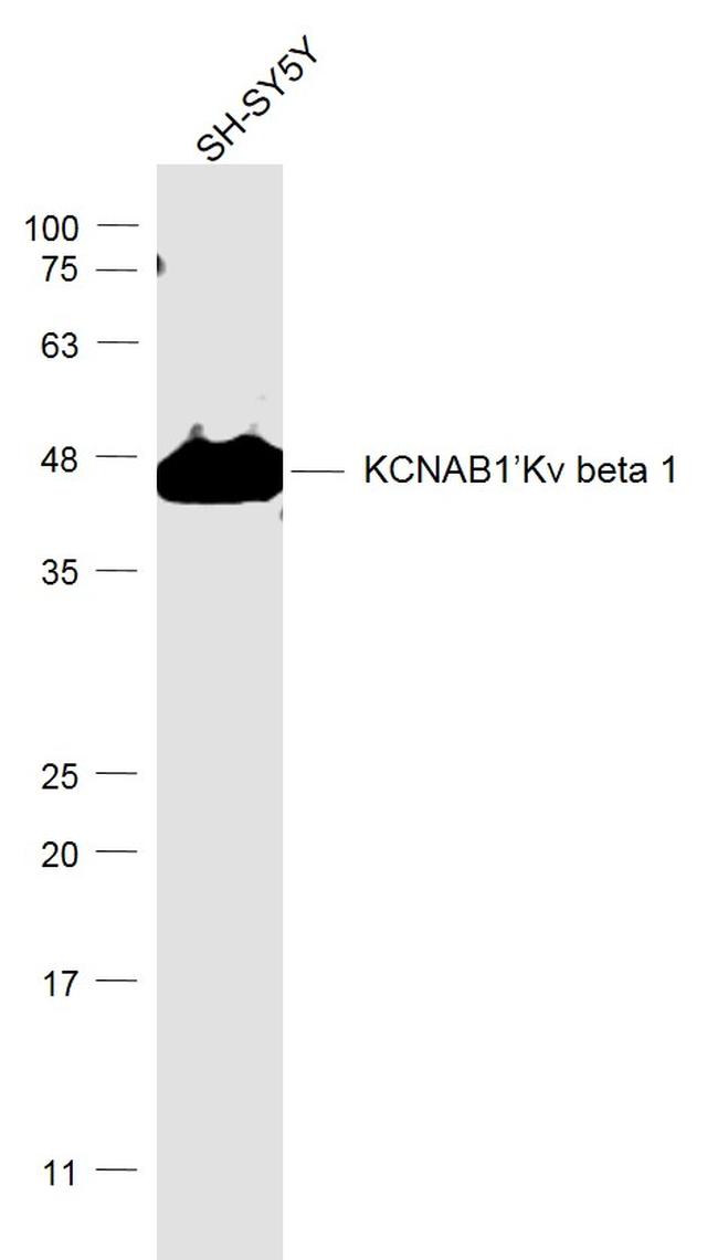 KCNAB1 Antibody in Western Blot (WB)