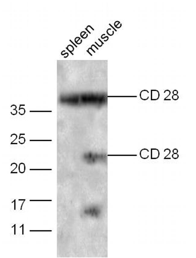 CD28 Antibody in Western Blot (WB)