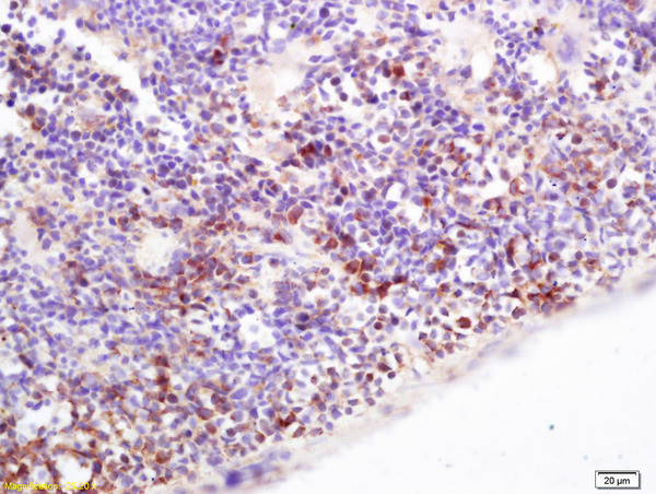 CD36 Antibody in Immunohistochemistry (Paraffin) (IHC (P))