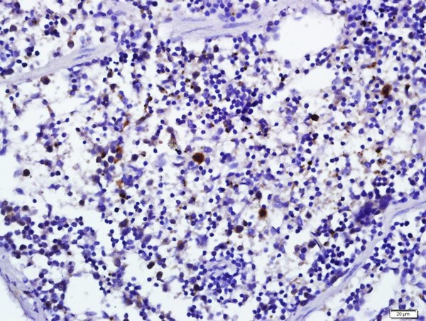 IFNA1 Antibody in Immunohistochemistry (Paraffin) (IHC (P))