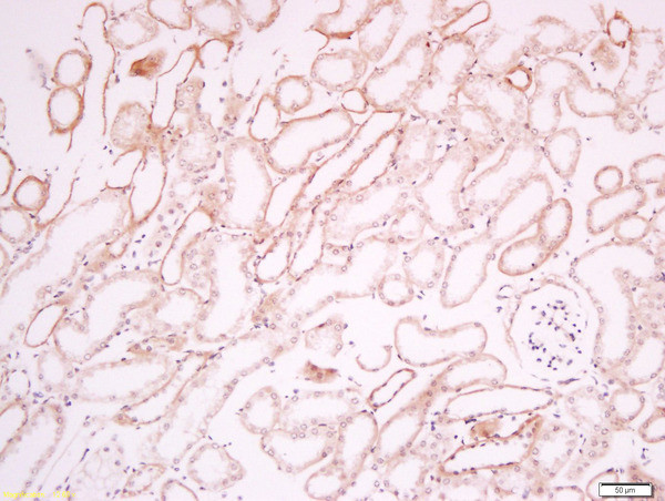 CD34 Antibody in Immunohistochemistry (Paraffin) (IHC (P))