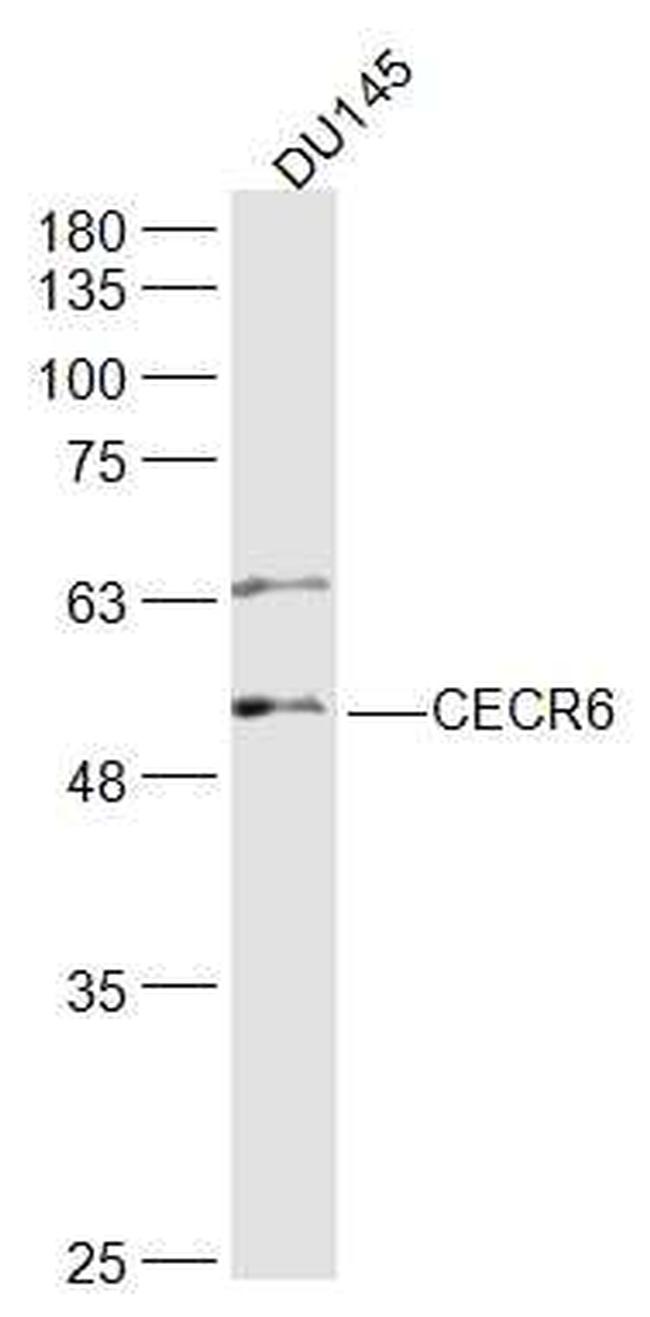 CECR6 Antibody in Western Blot (WB)