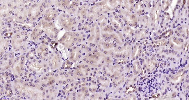 AKAP2 Antibody in Immunohistochemistry (Paraffin) (IHC (P))