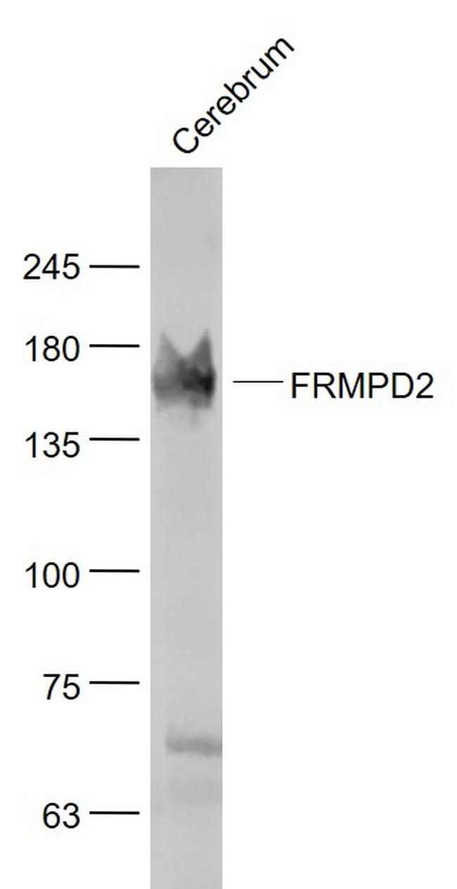 PDZK4 Antibody in Western Blot (WB)