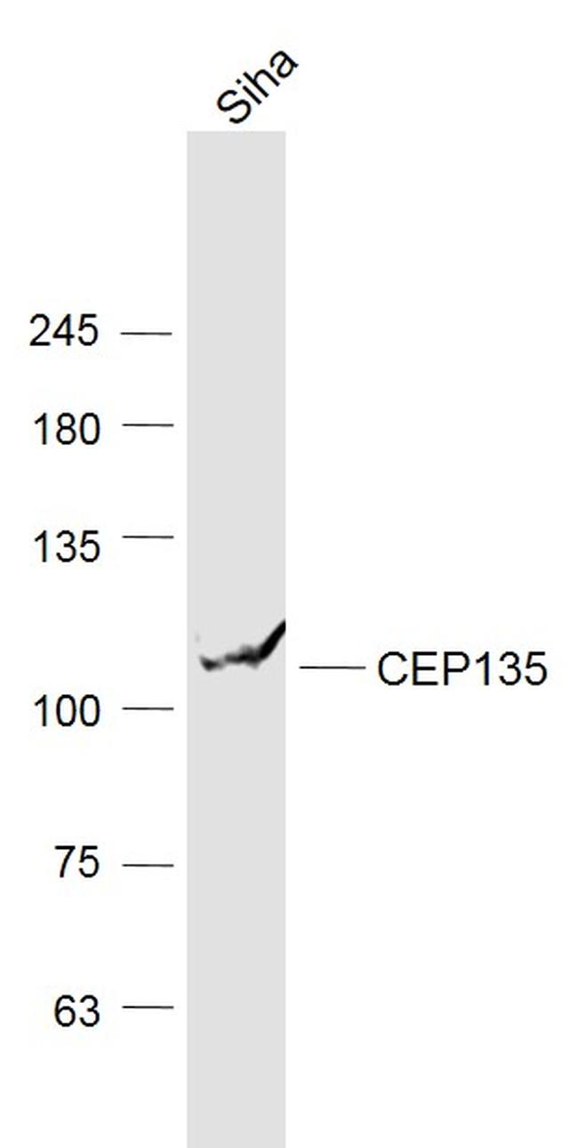 PDZD6 Antibody in Western Blot (WB)