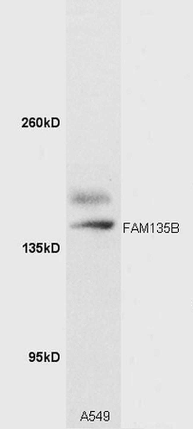 FAM135B Antibody in Western Blot (WB)