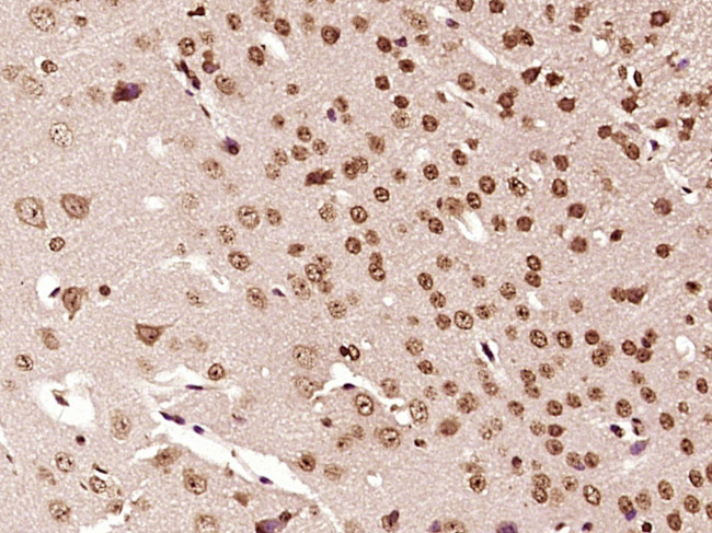 AKIRIN2 Antibody in Immunohistochemistry (Paraffin) (IHC (P))