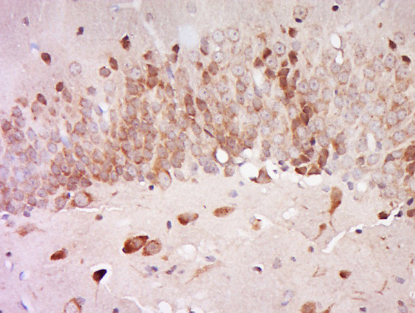 AGXT2L2 Antibody in Immunohistochemistry (Paraffin) (IHC (P))