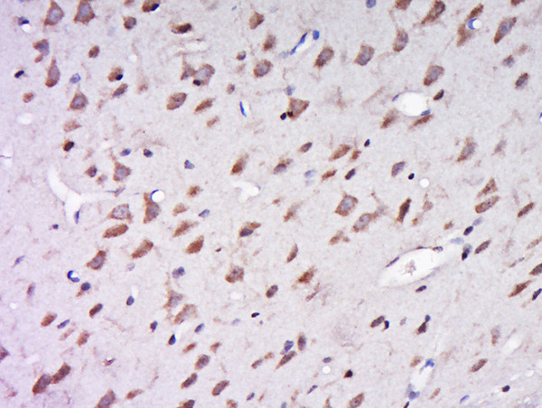 AER61 Antibody in Immunohistochemistry (Paraffin) (IHC (P))