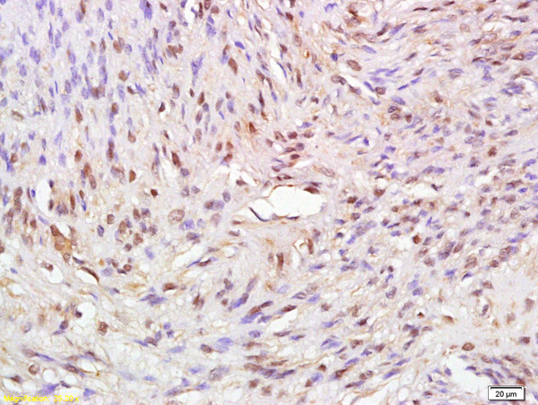 ATAD2 Antibody in Immunohistochemistry (Paraffin) (IHC (P))