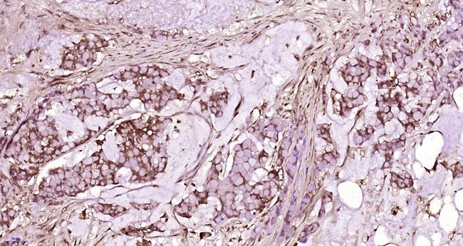 ATAD2 Antibody in Immunohistochemistry (Paraffin) (IHC (P))