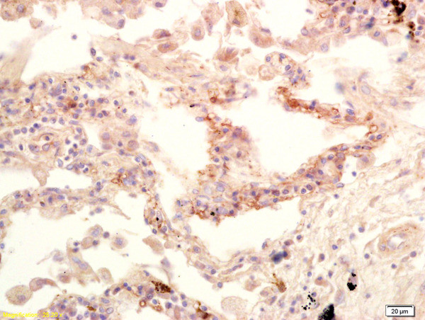 CSN1 Antibody in Immunohistochemistry (Paraffin) (IHC (P))