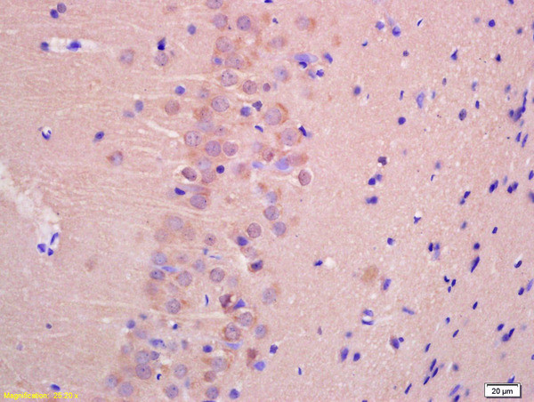 TTC33 Antibody in Immunohistochemistry (Paraffin) (IHC (P))