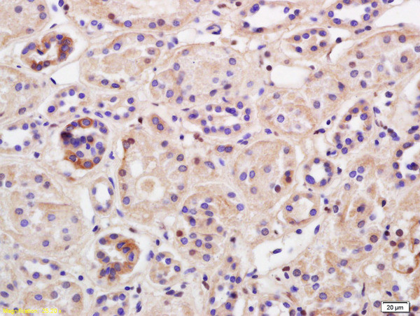 TRIM41 Antibody in Immunohistochemistry (Paraffin) (IHC (P))