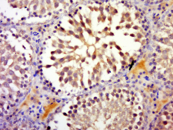 RNF17 Antibody in Immunohistochemistry (Paraffin) (IHC (P))