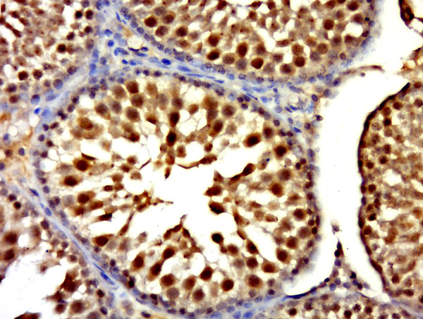 RNF6 Antibody in Immunohistochemistry (Paraffin) (IHC (P))
