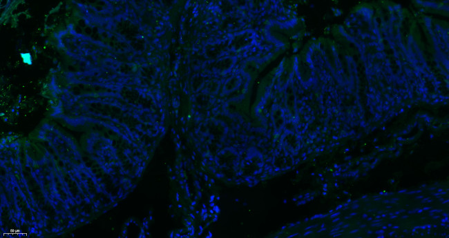 MTM1 Antibody in Immunohistochemistry (Paraffin) (IHC (P))