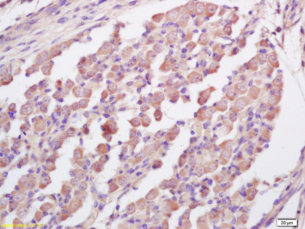 RNF123 Antibody in Immunohistochemistry (Paraffin) (IHC (P))