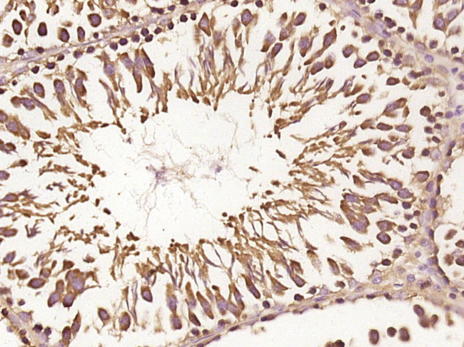 RNF170 Antibody in Immunohistochemistry (Paraffin) (IHC (P))