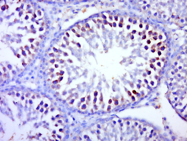 BTBD1 Antibody in Immunohistochemistry (Paraffin) (IHC (P))