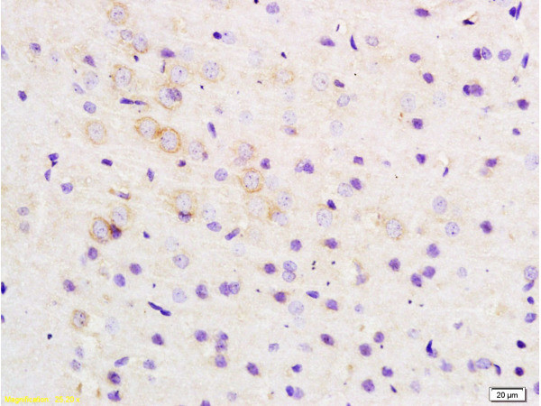 ARHGAP32 Antibody in Immunohistochemistry (Paraffin) (IHC (P))