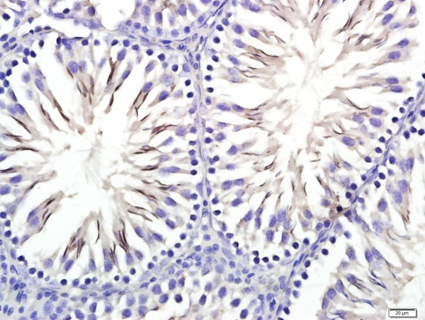 STIL Antibody in Immunohistochemistry (Paraffin) (IHC (P))