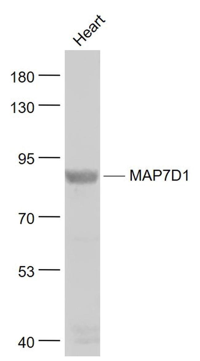 MAP7D1 Antibody in Western Blot (WB)