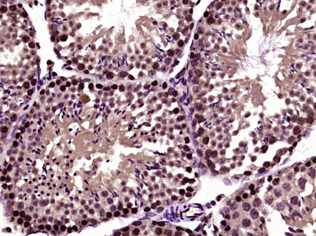 RanBP1 Antibody in Immunohistochemistry (Paraffin) (IHC (P))
