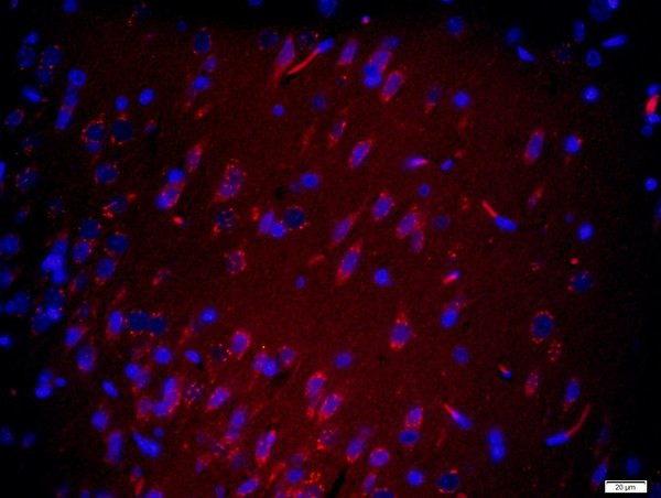 MYCBP2 Antibody in Immunohistochemistry (Paraffin) (IHC (P))