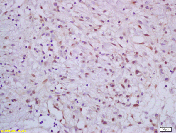 CRSP complex subunit 7/ARC70 Antibody in Immunohistochemistry (Paraffin) (IHC (P))