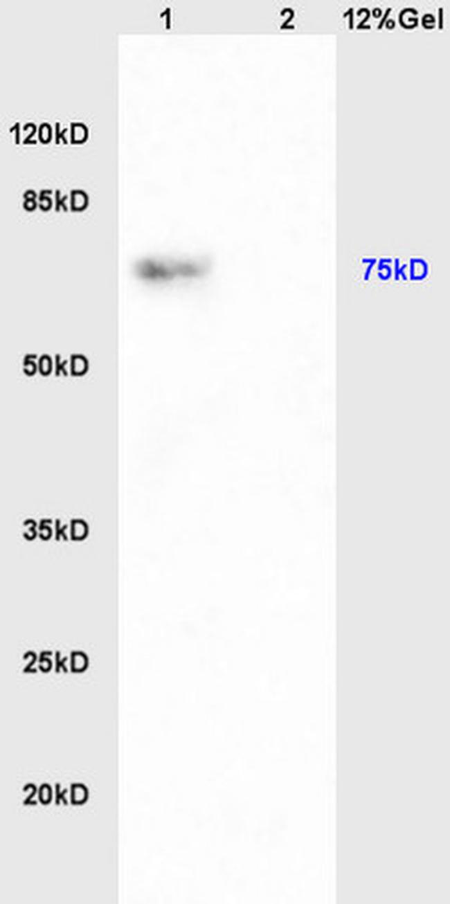 PAPOL A+B+G Antibody in Western Blot (WB)