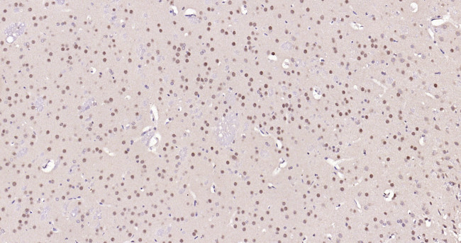 FOXO1A Antibody in Immunohistochemistry (Paraffin) (IHC (P))