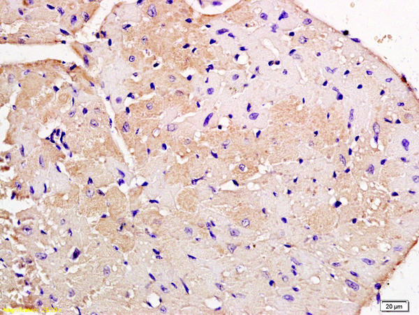 Nebulette Antibody in Immunohistochemistry (Paraffin) (IHC (P))