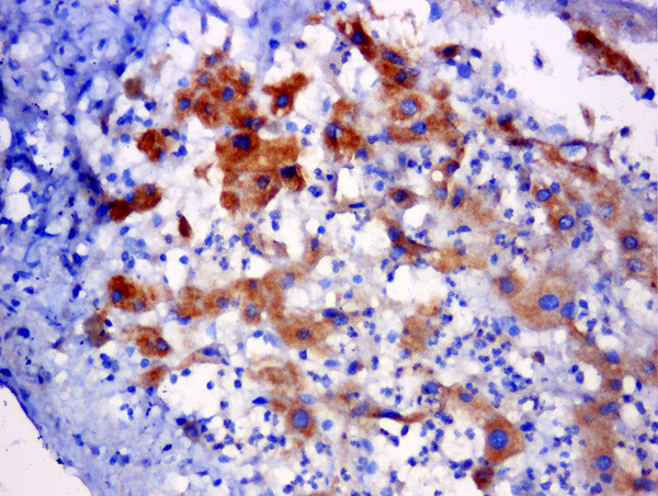 C5orf51 Antibody in Immunohistochemistry (Paraffin) (IHC (P))