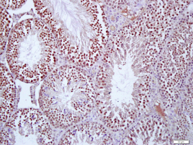 Protein S Antibody in Immunohistochemistry (Paraffin) (IHC (P))