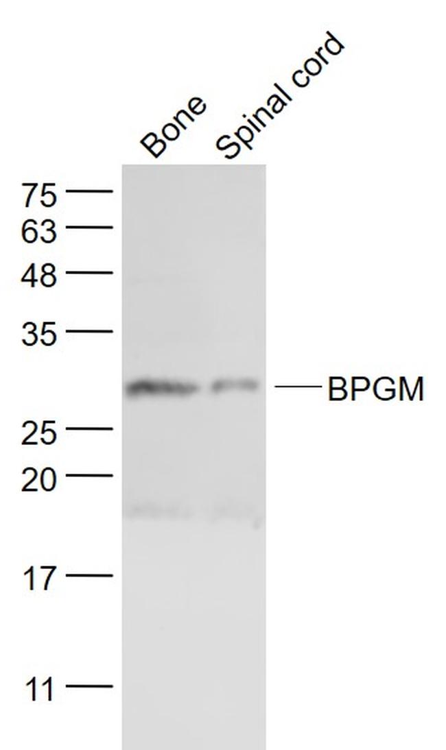 BPGM Antibody in Western Blot (WB)