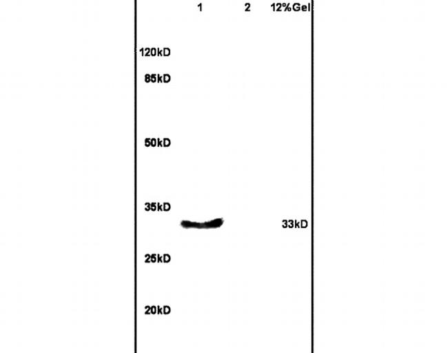 KLF1, 2, 4 Antibody in Western Blot (WB)
