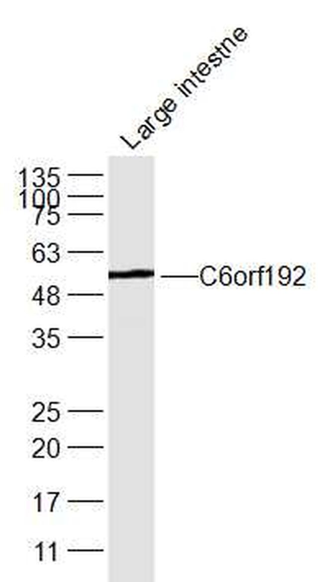 C6orf192 Antibody in Western Blot (WB)