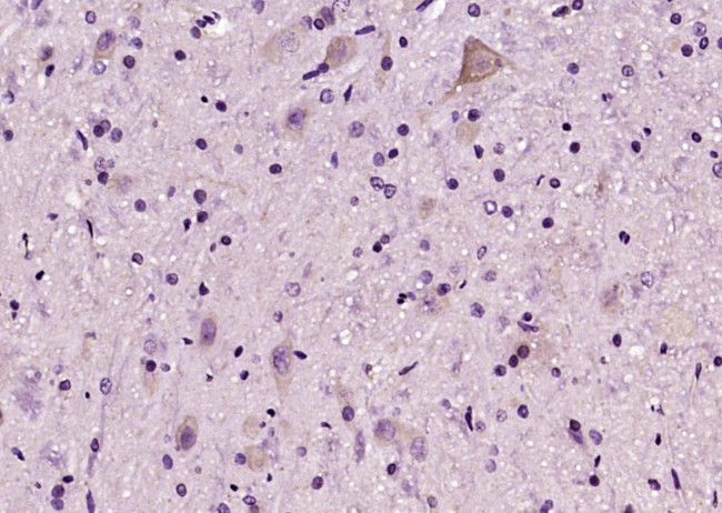C6orf120 Antibody in Immunohistochemistry (Paraffin) (IHC (P))