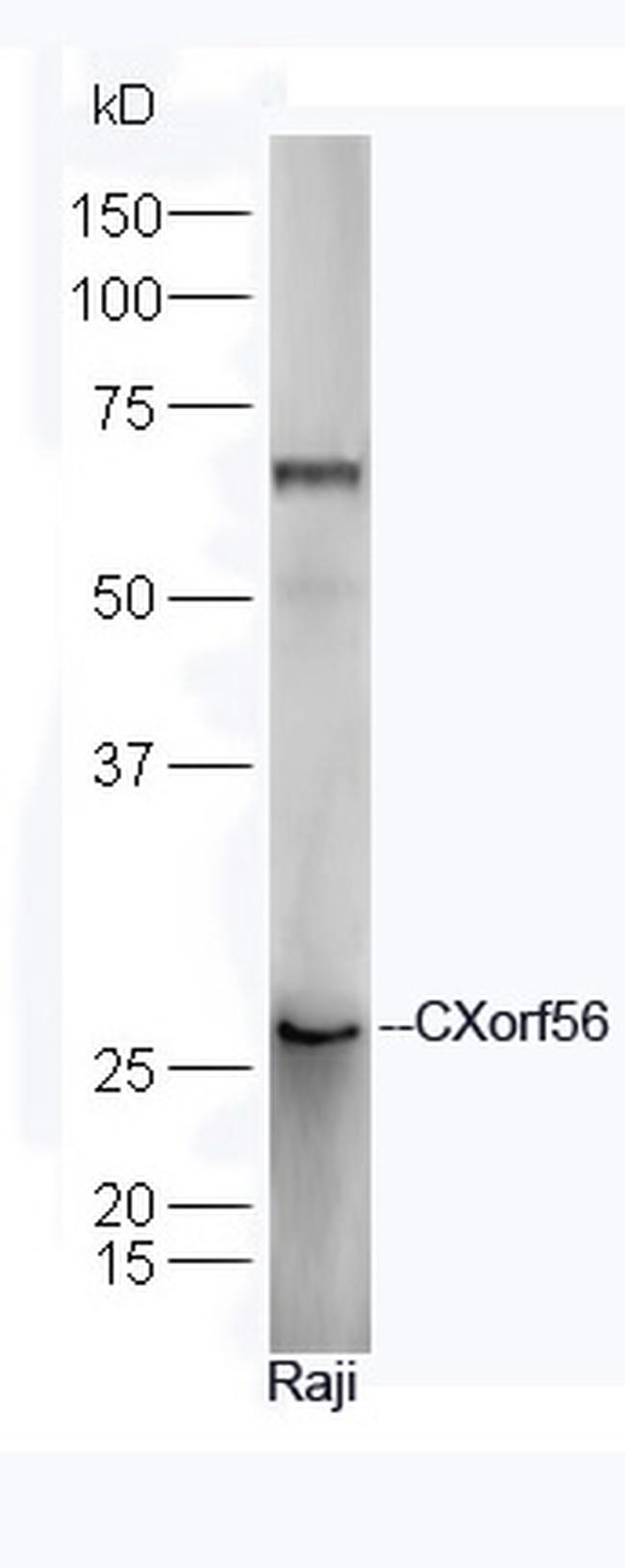 CXorf56 Antibody in Western Blot (WB)