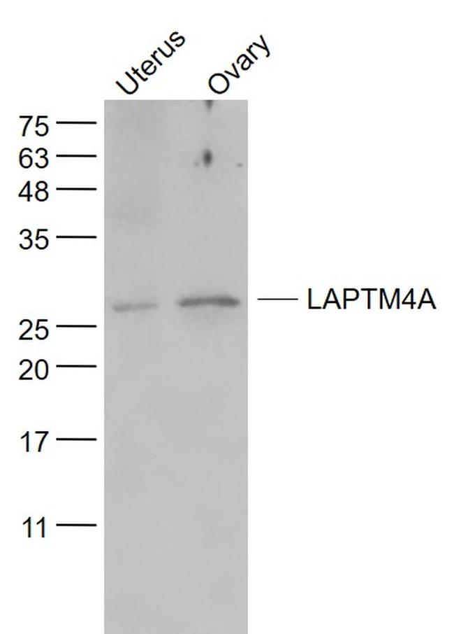 LAPTM4A Antibody in Western Blot (WB)