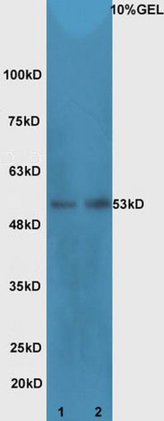 Cdc25C Antibody in Western Blot (WB)