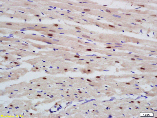 RBM20 Antibody in Immunohistochemistry (Paraffin) (IHC (P))