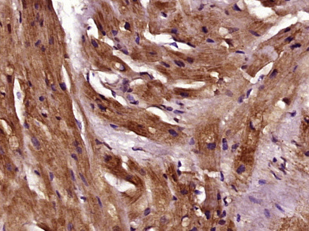 TPM1/2/3/4 Antibody in Immunohistochemistry (Paraffin) (IHC (P))