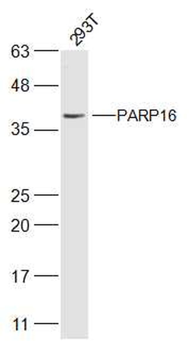 PARP16 Antibody in Western Blot (WB)